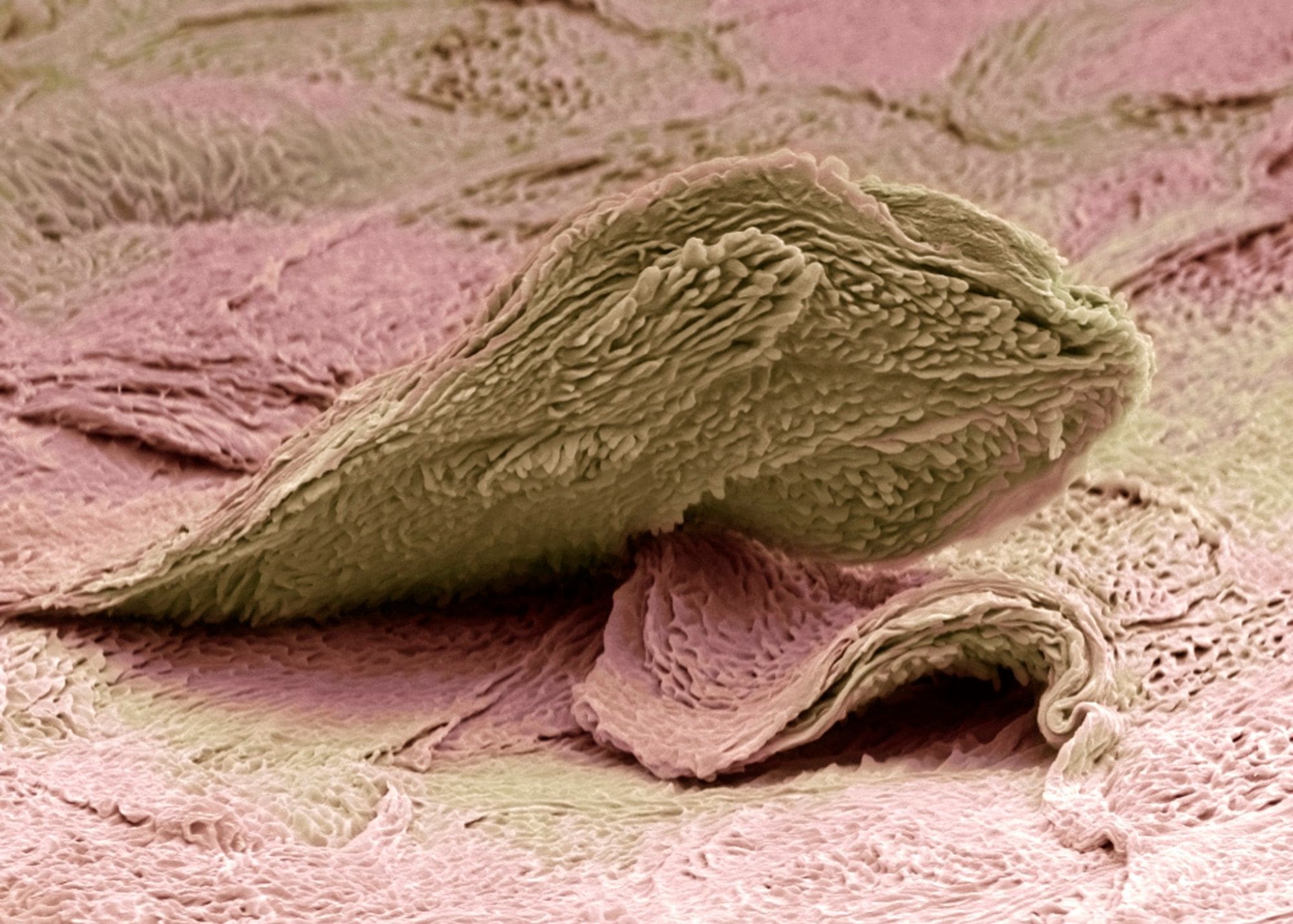 Glycolic acid helps remove dead skin cells